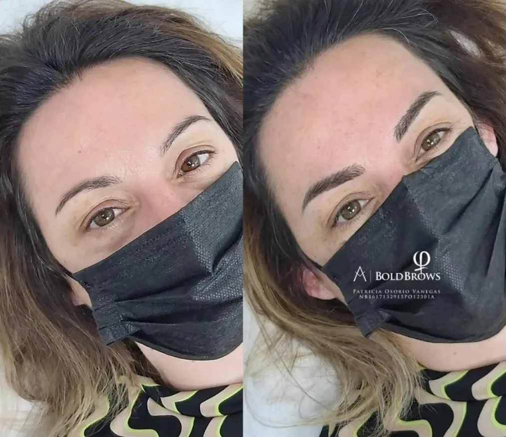 Cejas finas antes y cejas definidas después del tratamiento